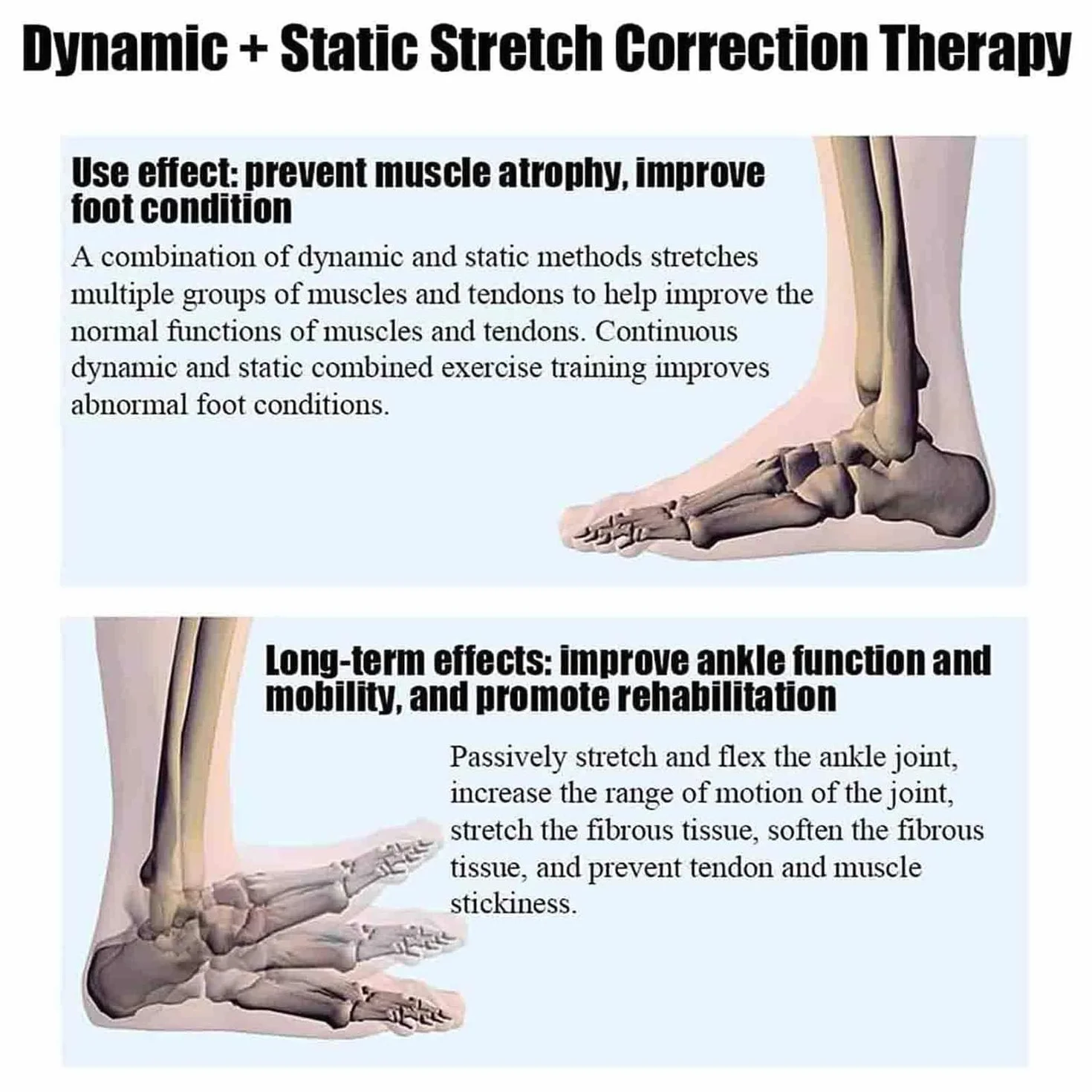 Appareil d'entraînement électrique cheville rééducation pied angle complet 0-50° pour ligaments raides fracture hémiplégique