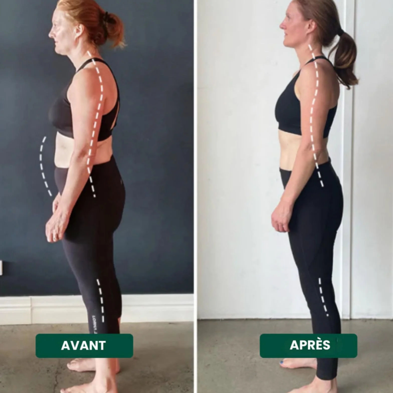 OALYGEI Ceinture Bruvella Dorsale Soulage les douleurs dorsales et améliore la posture,Correcteur de Posture Ajustable (rose, S(55-90KG))